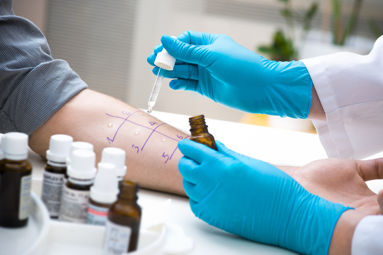 Allergy Testing: Types & Benefits